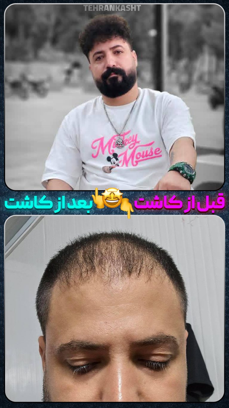 قبلو بعد copy