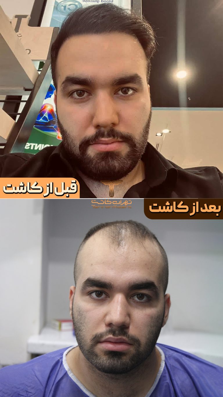 قبو بعد مدل جدید copy