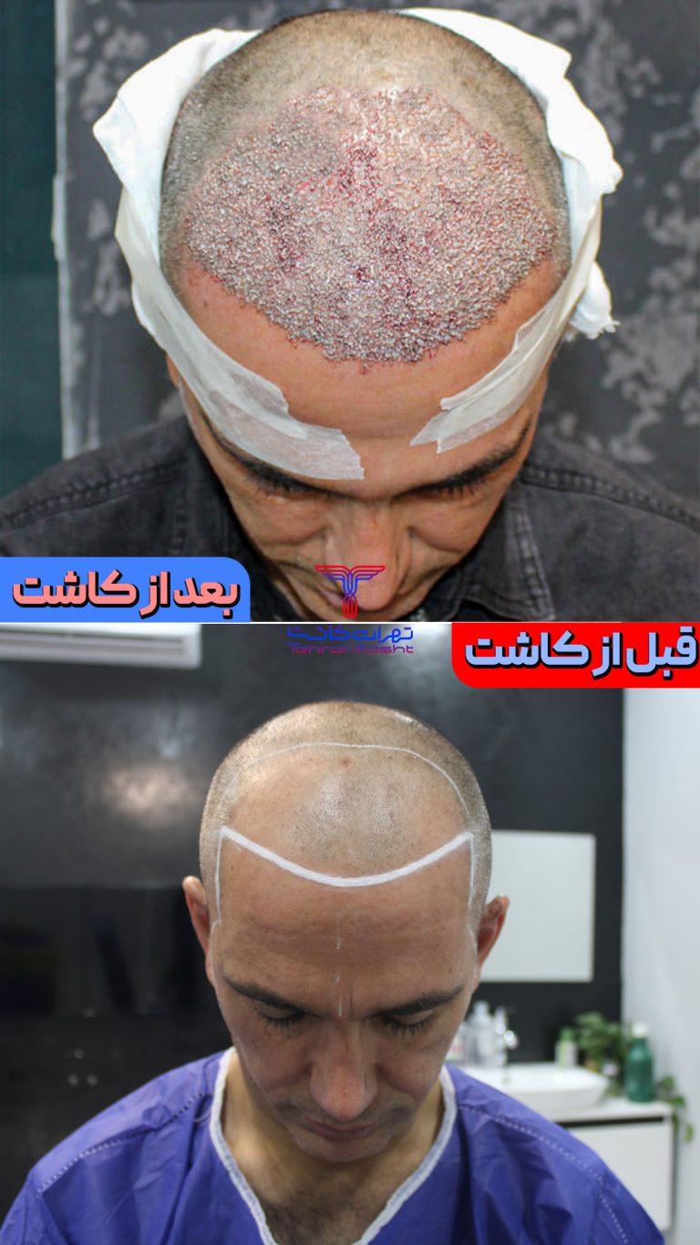 قبو بعد45 مدل جدید copy